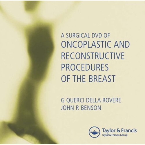 A Surgical Dvd Of Oncoplastic And Reconstruct...