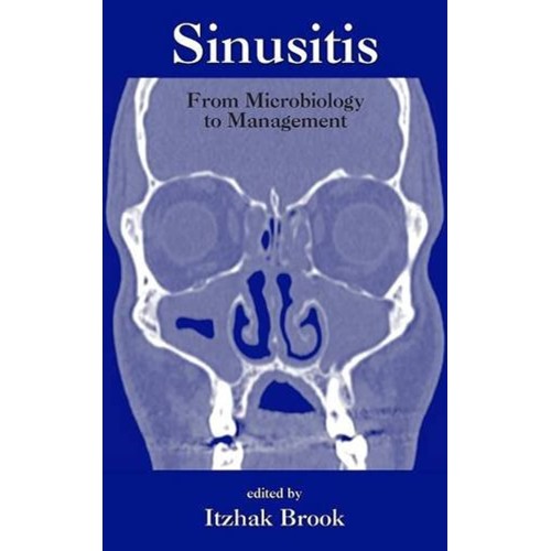 Sinusitis From Microbiology To Management 