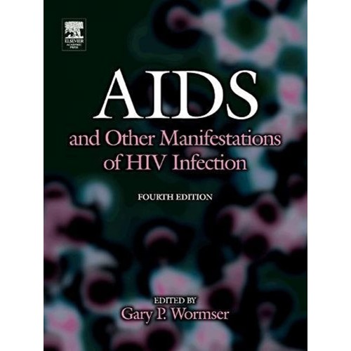 Aids And Other Manifestations Of Hiv Infectio...