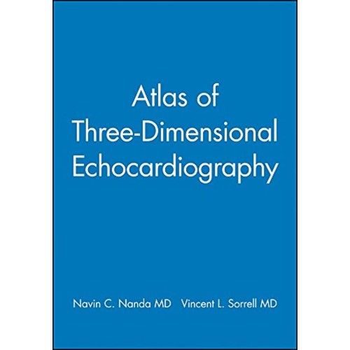 Atlas Of Threedimensional Echocardiography 20...