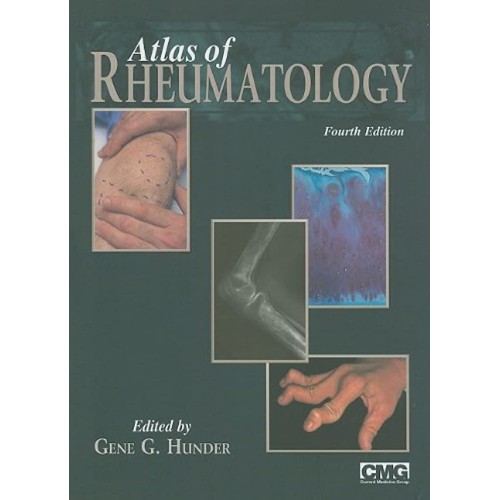 Atlas Of Rheumatology 4Ed (Hb 2009)