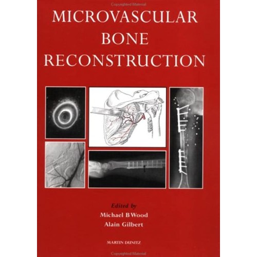 Microvascular Bone Reconstruction 
