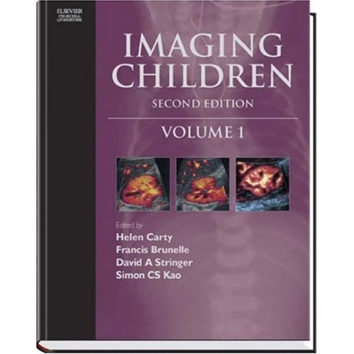 Imaging Children, 2E 2 Vol. Set (Hb) 
