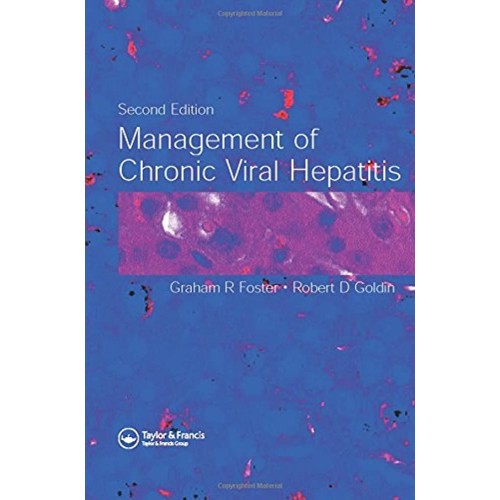 Management Of Chronic Viral Hepatitis 