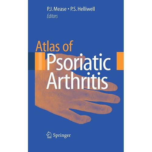Atlas Of Psoriatic Arthritis (Hb 2008)
