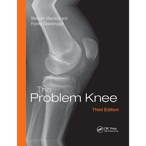The Problem Knee 3Ed (Pb 2018) 