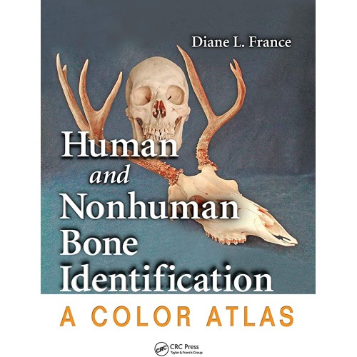 Human And Nonhuman Bone Identification A Colo...