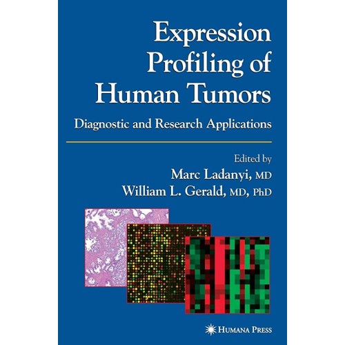 Expression Profiling Of Human Tumors: Diagnos...