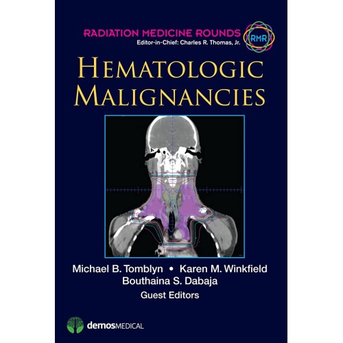 Hematologic Malignancies (Hb 2012) 
