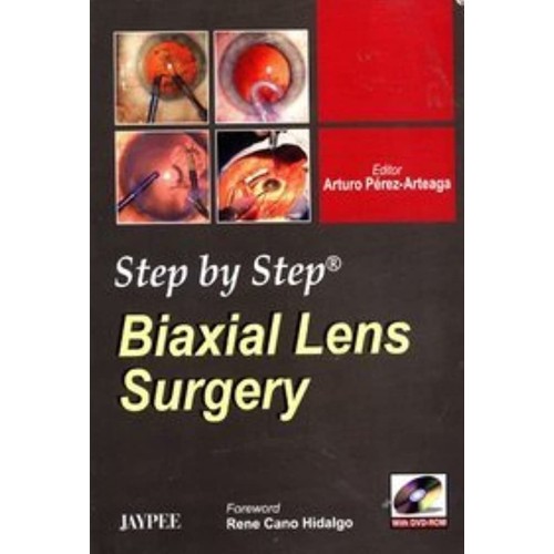 STEP BY STEP BIAXIAL LENS SURGERY WITH DVD-ROM