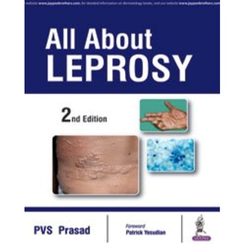 ALL ABOUT LEPROSY