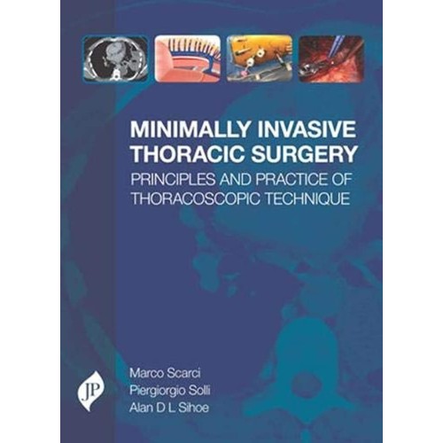 MINIMALLY INVASIVE THORACIC SURGERY PRINCIPLE...