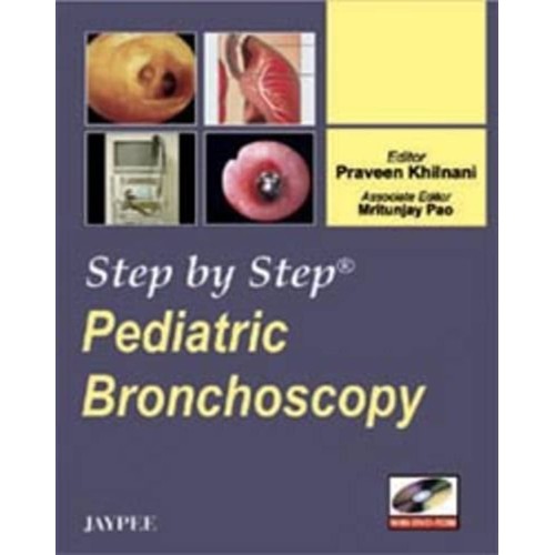 STEP BY STEP PEDIATRIC BRONCHOSCOPY WITH DVD-ROM