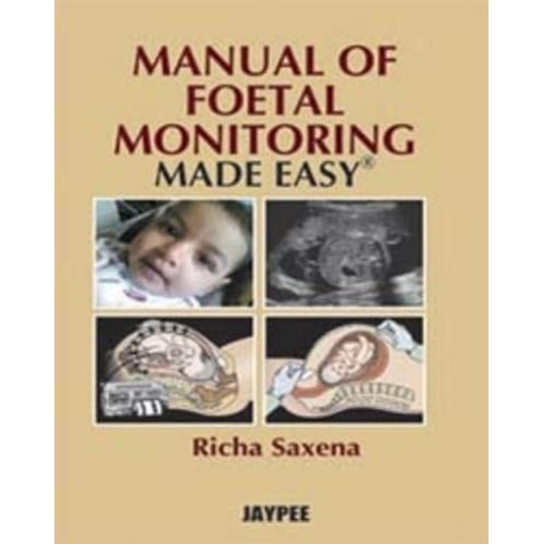 MANUAL OF FOETAL MONITORING MADE EASY