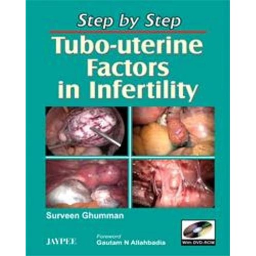 STEP BY STEP TUBO-UTERINE FACTORS IN INFERTIL...