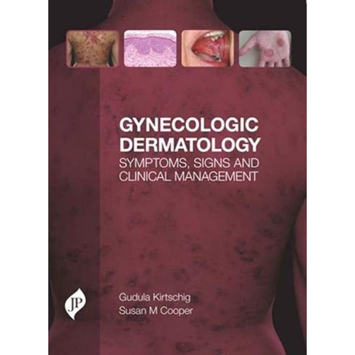 GYNECOLOGIC DERMATOLOGY SYMPTOMS, SIGNS AND C...