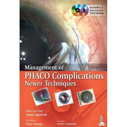 MANAGEMENT OF PHACO COMPLICATIONS NEWER TECHN...