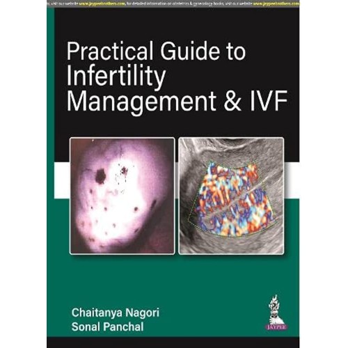 PRACTICAL GUIDE TO INFERTILITY MANAGEMENT & IVF