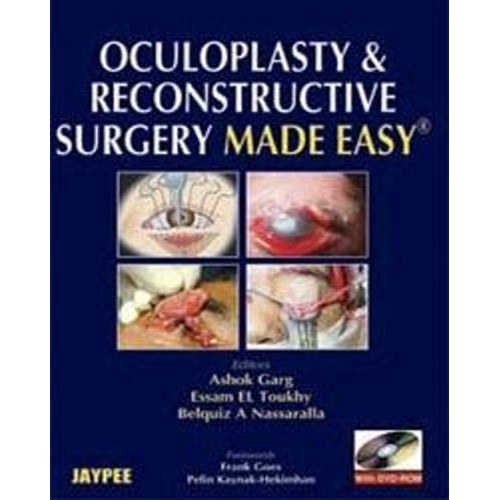 OCULOPLASTY & RECONSTRUCTIVE SURGERY MADE EASY WITH DVD-ROM