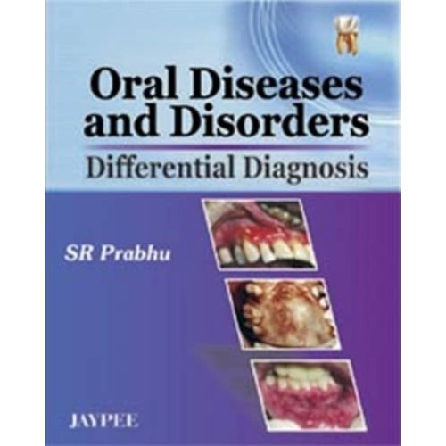 ORAL DISEASES AND DISORDERS DIFFERENTIAL DIAGNOSIS