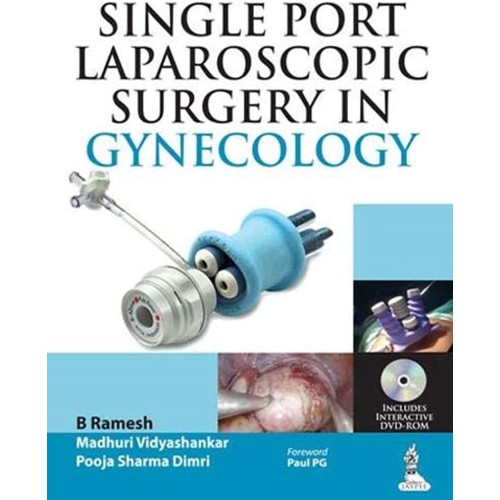 SINGLE PORT LAPAROSCOPIC SURGERY IN GYNECOLOGY INCLUDES DVD-ROM