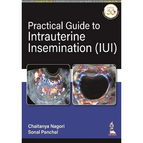 PRACTICAL GUIDE TO INTRAUTERINE INSEMINATION (IUI)