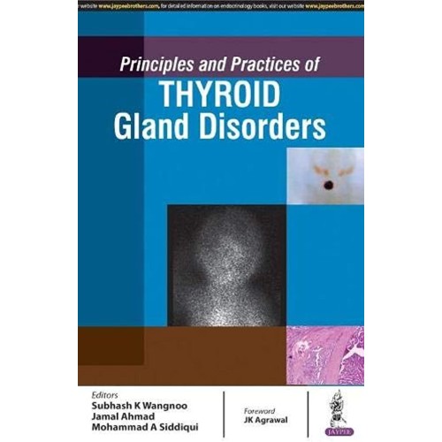 PRINCIPLES AND PRACTICES OF THYROID GLAND DISORDERS