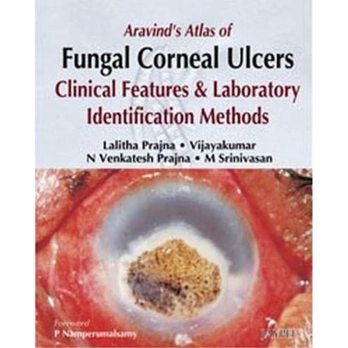 ARAVIND'S ATLAS OF FUNGAL CORNEAL ULCERS CLINICAL FEATURES & LAB.IDENTIFICATION METHODS