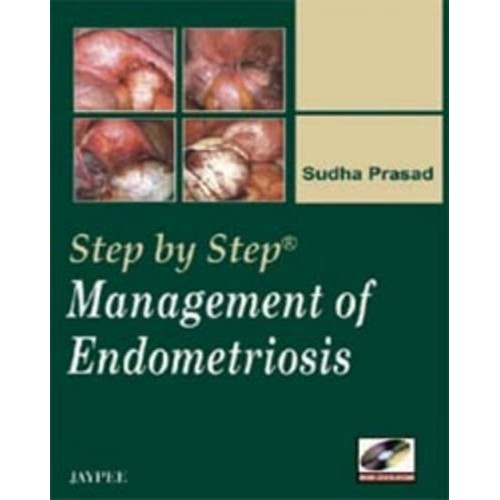 STEP BY STEP MANAGEMENT OF ENDOMETRIOSIS WITH DVD-ROM