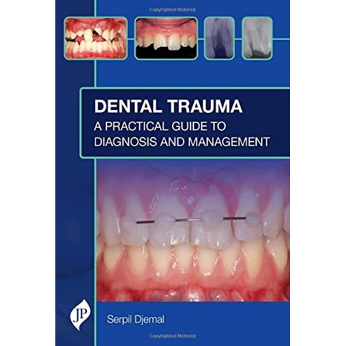 DENTAL TRAUMA: A PRACTICAL GUIDE TO DIAGNOSIS...