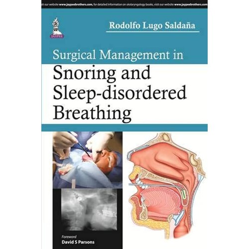 SURGICAL MANAGEMENT IN SNORING AND SLEEP-DISORDERED BREATHING