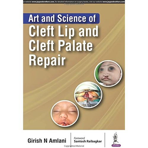 ART AND SCIENCE OF CLEFT LIP AND CLEFT PALATE...