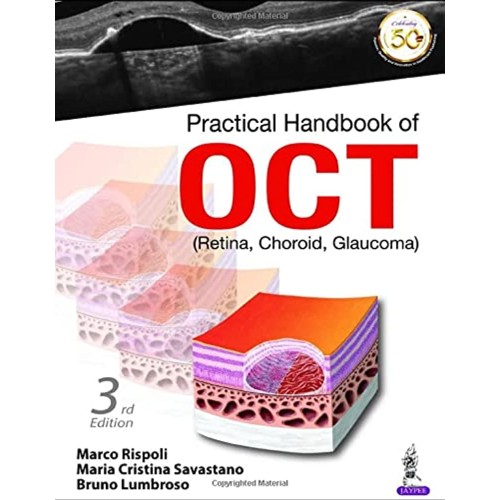 PRACTICAL HANDBOOK OF OCT (RETINA, CHOROID, GLAUCOMA)