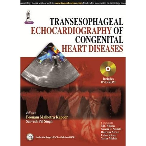 TRANSESOPHAGEAL ECHOCARDIOGRAPHY OF CONGENITAL HEART DISEASES