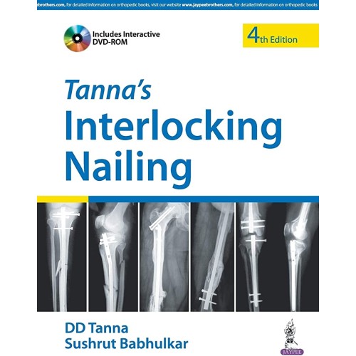 TANNA'S INTERLOCKING NAILING WITH DVD-ROM