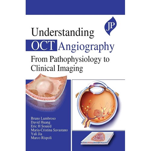 UNDERSTANDING OCT ANGIOGRAPHY FROM PATHOPHYSIOLOGY TO CLINICAL IMAGING