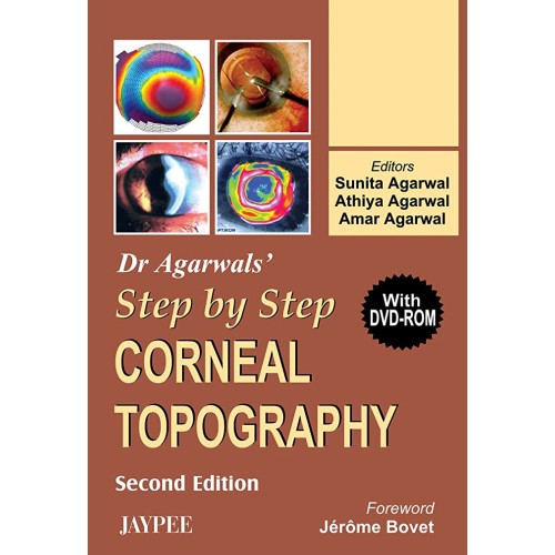 DR. AGARWALS' STEP BY STEP CORNEAL TOPOGRAPHY...