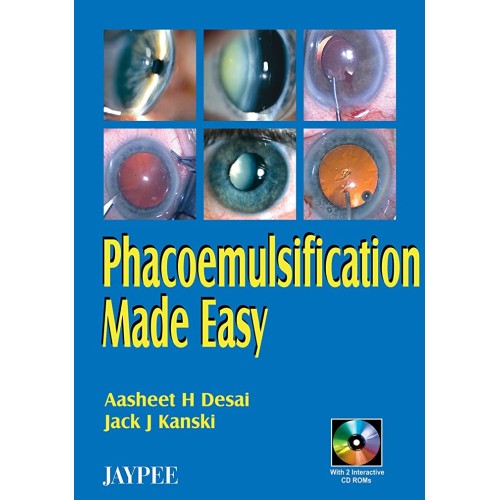 PHACOEMULSIFICATION MADE EASY WITH 2 INT.CD ROMS
