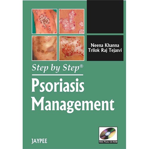 STEP BY STEP PSORIASIS MANAGEMENT WITH PHOTO CD-ROM