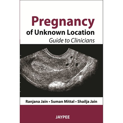 PREGNANCY OF UNKNOWN LOCATION GUIDE TO CLINICIANS