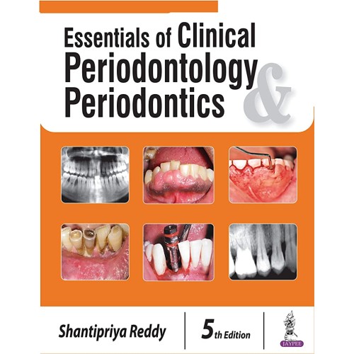 ESSENTIALS OF CLINICAL PERIODONTOLOGY PERIODO...