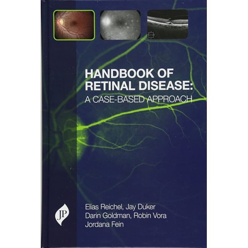 HANDBOOK OF RETINAL DISEASE : A CASE-BASED AP...
