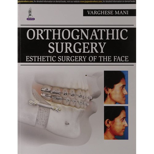 ORTHOGNATHIC SURGERY ESTHETIC SURGERY OF THE FACE