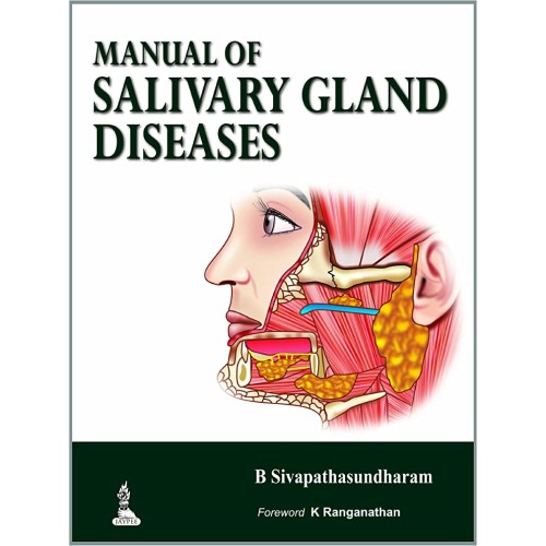 MANUAL OF SALIVARY GLAND DISEASES