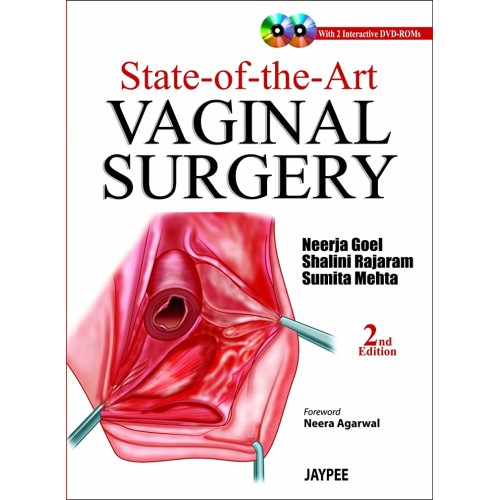 STATE-OF-THE ART VAGINAL SURGERY WITH 2-INTERACTIVE DVD-ROMS