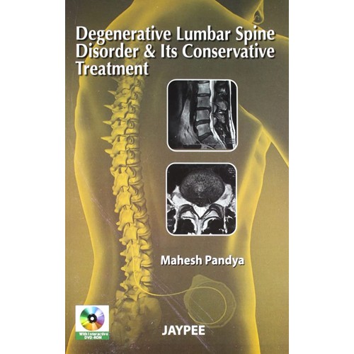 DEGENERATIVE LUMBAR SPINE DISORDER & ITS CONS...