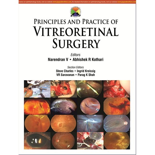 PRINCIPLES AND PRACTICE OF VITREORETINAL SURGERY