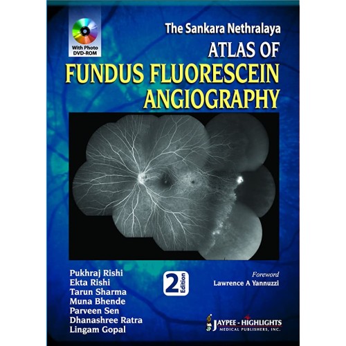 THE SANKARA NETHRALAYA ATLAS OF FUNDUS FLUORESCEIN ANGIOGRAPHY WITH PHOTO DVD-ROM