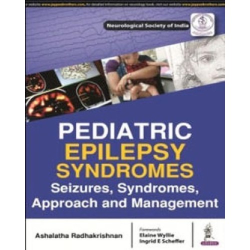 PEDIATRIC EPILEPSY SYNDROMES SEIZURES, SYNDROMES, APPROACH AND MANAGEMENT