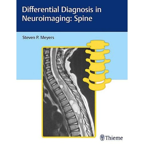 Differential Diagnosis in Neuroimaging Spine ...